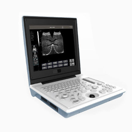 Portable ultrasound system - SS-6B - Sonostar Technologies - for multipurpose ultrasound imaging / B/W / built-in console