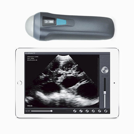 Hand-held ultrasound system - UProbe-1  - Sonostar Technologies - for multipurpose ultrasound imaging / B/W / all-in-one probe