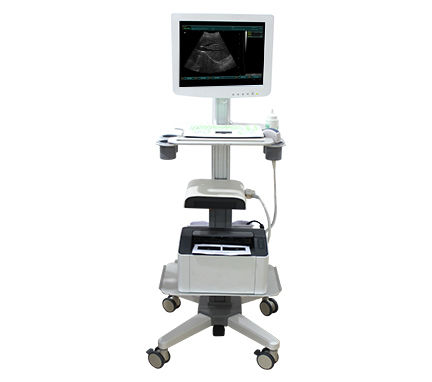 On-platform, compact ultrasound system - SS-100 Touch Screen Trolley Ultrasound Diagnosis B - Sonostar Technologies - for multipurpose ultrasound imaging / color doppler