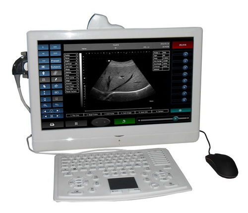 On-platform, Tabletop Ultrasound System - UTouch-8 - Sonostar ...