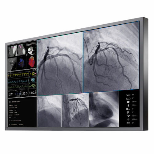 OR monitor - CuratOR® LX550W - EIZO GmbH - medical imaging / 4K / 55"