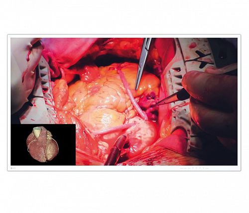 Surgical monitor - CuratOR® EX4942 - EIZO GmbH - medical / 4K / 49in