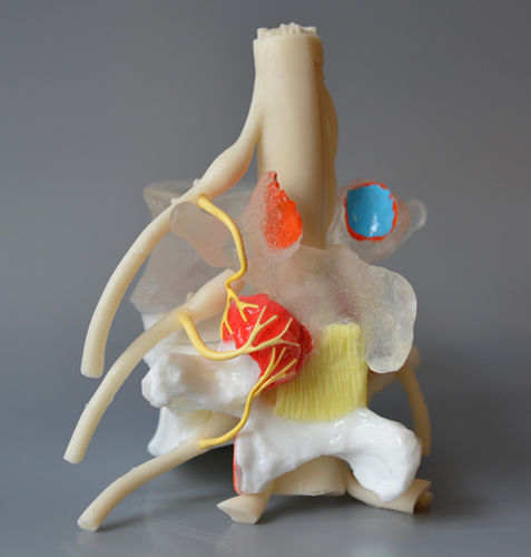 Intervetebral disc model - Medial Branch  - Dynamic Disc Designs Corp. - for teaching / with nerves / white