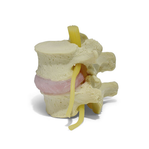 Lumbar vertebra anatomical model - Classic LxH - Dynamic Disc Designs Corp. - intervertebral disc / for teaching / white