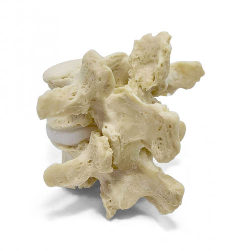 Lumbar spine anatomical model - Dynamic Disc Designs Corp. - intervertebral disc / surgery / for teaching