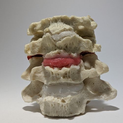Intervetebral disc model - Dynamic Disc Designs Corp. - cervical / for teaching