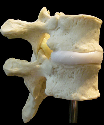 Intervetebral disc model - Dynamic Disc Designs Corp. - thoracic vertebra / gynecological / for teaching