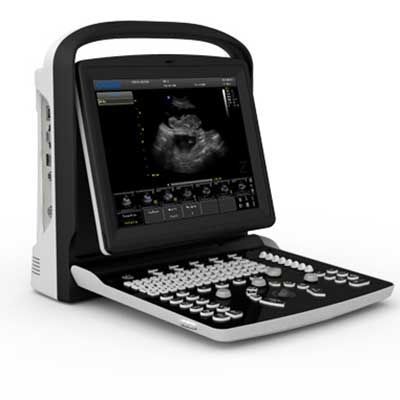 Portable veterinary ultrasound system - Chison Eco3 - Diagnostic Imaging Systems - multipurpose / for small animals / for large animals