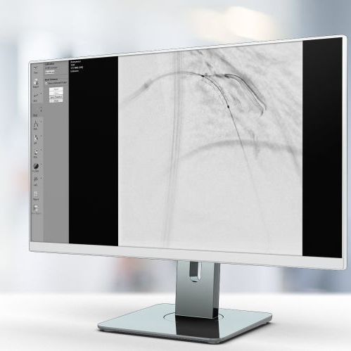 Image enhancement software - StentEnhancer - Pie Medical Imaging - visualization / medical / cardiology