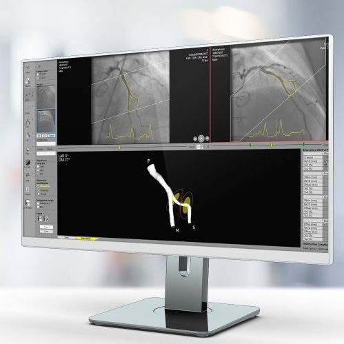 Analysis software - QCA  - Pie Medical Imaging - reporting / calibration / contour detection