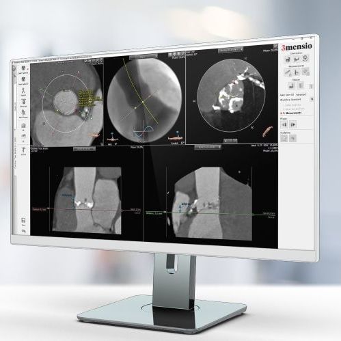 Analysis software - Pie Medical Imaging - reporting / visualization / measurement
