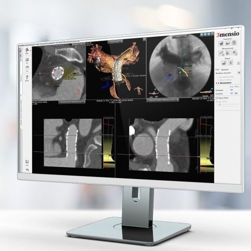 Reporting software - Pie Medical Imaging - planning / treatment / hospital