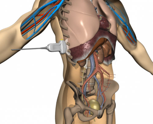 Ultrasound imaging patient simulator - ICCU - Elevate Healthcare - for clinical care / for critical care / workstation