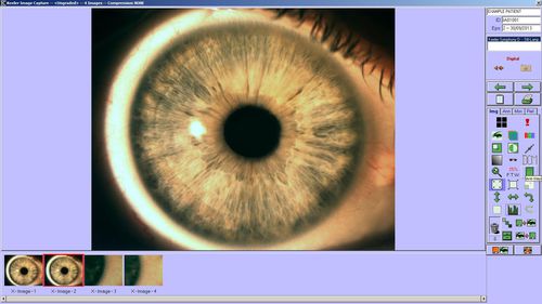 Measurement software - 3020-P-7042 - Keeler - import / file import / capture