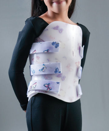 Thoraco-lumbo-sacral support corset - Custom Bivalve - Optec USA - pediatric / lordosis