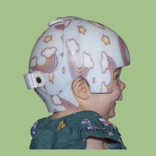 Cranial orthosis - STARband Bi-Valve - Orthomerica - pediatric