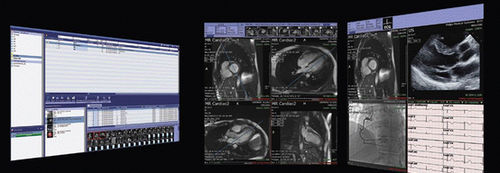 Sharing software - iNteract™ + ¡Review - TeraRecon - diagnostic / visualization / clinical