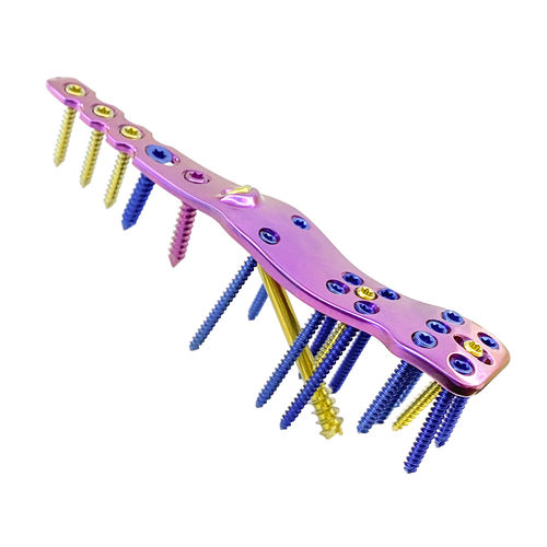 Ankle arthrodesis plate - HJ-VA-LOC 03 - Health-Joy Medical - lateral / locking / titanium