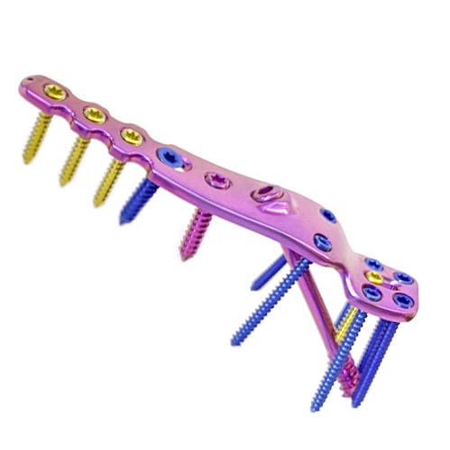 Ankle arthrodesis plate - HJ-VA-LOC 07 - Health-Joy Medical - lateral / locking / titanium