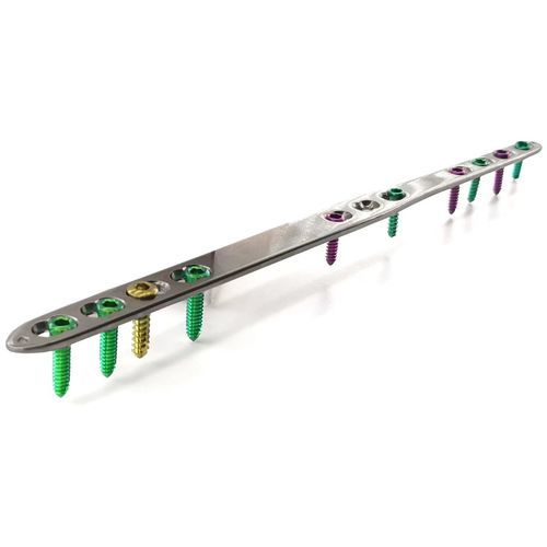 Wrist arthrodesis plate - HJ-Small Dorsal Spanning - Health-Joy Medical - carpal joint / hand phalange / metacarpophalangeal joint