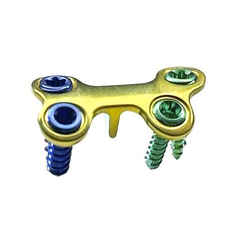 Forefoot osteotomy plate - HJ-VA-LOC 01 - Health-Joy Medical