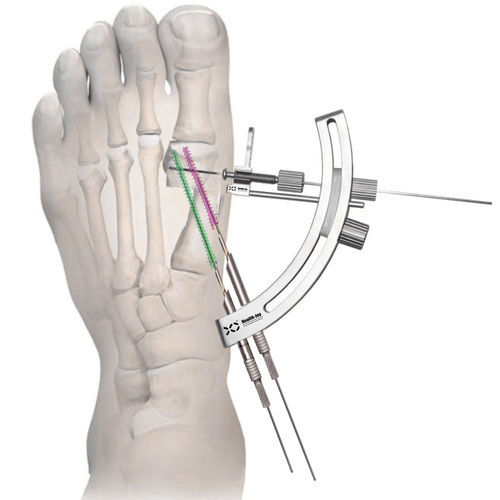 Minimally invasive forefoot surgery instrument kit - HJ-Bunion  - Health-Joy Medical