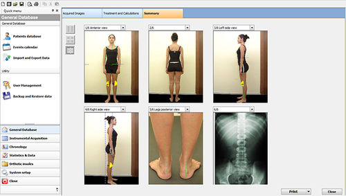 Analysis software - Sensor Medica - measurement / posturography
