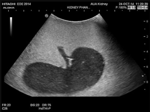 Ultrasound imaging test phantom - Yezitronix - kidney