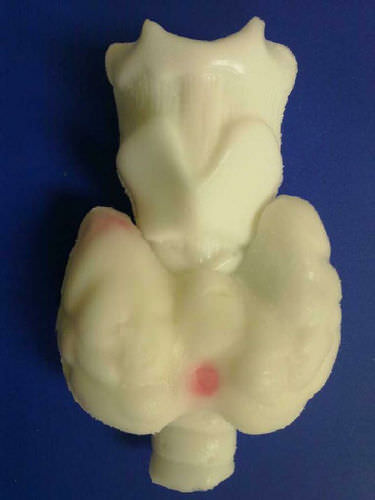 Thyroid test phantom - Yezitronix - for ultrasound imaging