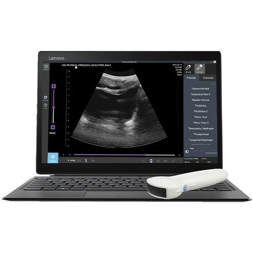Portable ultrasound system - (TUI-S-T) Pathway® US  - The Prometheus Group - for abdominal and pelvic ultrasound imaging / B/W / color doppler