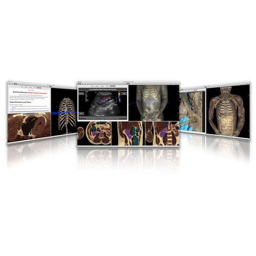 Training software - VH Dissector - Touch of Life Technologies (ToLTech) - anatomy