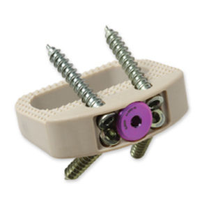 Lumbar interbody fusion cage - Vault® - Precision Spine - anterior / PEEK