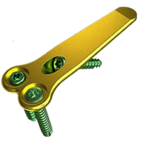 Hallux valgus arthrodesis plate - MAXLOCK™ EXTREME™ - Wright Medical Technology - distal / proximal / locking
