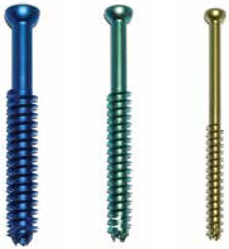 Radius osteotomy screw - MAXTORQUE™ - Wright Medical Technology - olecranon / tibia / fibula