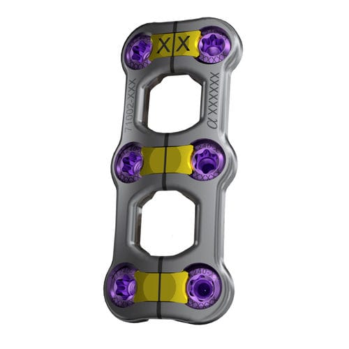 Cervical arthrodesis plate - Trestle Luxe™ - Alphatec Spine - locking / 2 levels