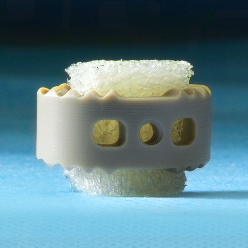 Allograft bone substitute - 3D Profuse® - Alphatec Spine - for