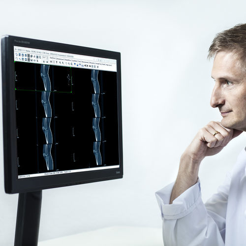 Medical imaging PACS SoliPACS™ EBM Technologies