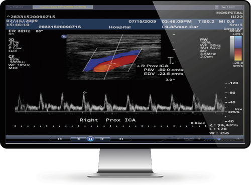 Data management software - INFINITT North America - medical / hospital / cardiology
