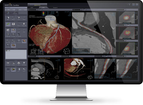 Analysis software - Xelis™ Cardiac - INFINITT North America - 3D viewing / diagnostic / measurement