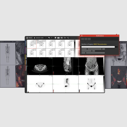 Analysis software - MIM Encore® - MIM Software - visualization / diagnostic / PET
