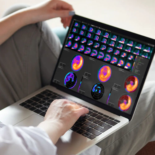 Analysis software - MIMcardiac® - MIM Software - clinical / CT / PET