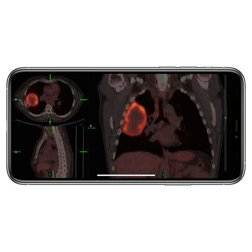 Access control iOS application - VueMe™ - MIM Software - import / medical imaging / iOS