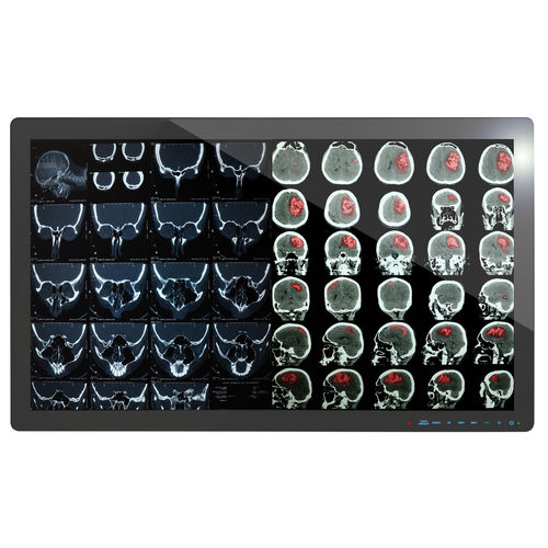 Medical display - 4K2K - Richardson Electronics - Healthcare - full HD / 4K / 32"