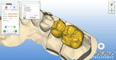 Dental prosthesis design software - ORIGIN HD - B&D Dental Technologies - CAD / CAM