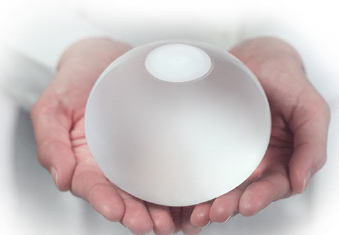 Non-surgical intragastric balloon - ORBERA® - Apollo Endosurgery