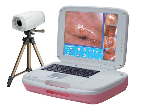 Video colposcope - AD-2000Y  - Xuzhou Kejian Hi-tech - transportable