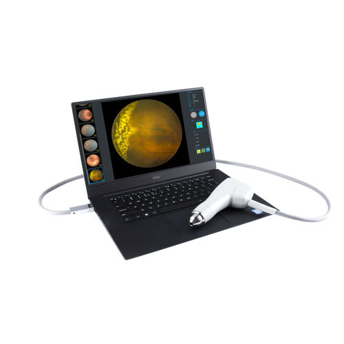 Non-mydriatic retinal camera - SW-8000P - Tianjin Suowei Electronic Technology - eye fluorescein angiography / hand-held