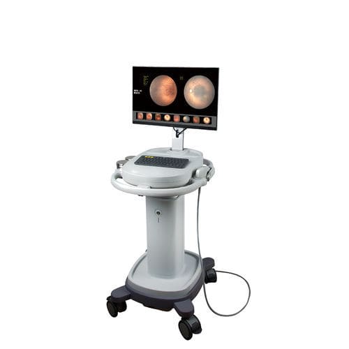 Non-mydriatic retinal camera - SW-8000 - Tianjin Suowei Electronic Technology - eye fluorescein angiography / trolley-mounted