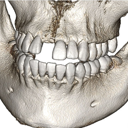 Dental Software - Invivo6 - Anatomage - Medical   Ct   Analysis