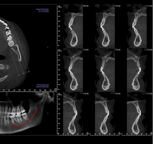 Anatomage Dental ANATOMAGE TABLE CLINICAL Portable Virtual
